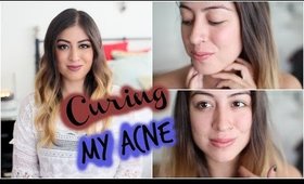 Update: My Acne Story + How I Cured my Acne