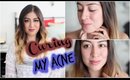 Update: My Acne Story + How I Cured my Acne