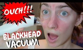 Blackhead Vacuum | Does It Work???