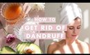 How to Get Rid of Dandruff | Home Remedies