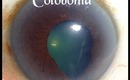 Coloboma, Corneal-Arcus, Micro-Phthalmia, Astigmatism and Aging