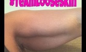 Loose Skin and What Keeps Me On Motivated