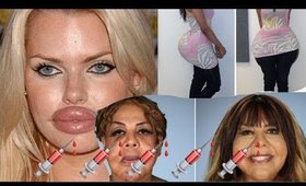 The New Price of Beauty. Filler and Shot Epidemic is KILLING OUR WOMEN.