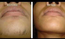 How to get rid of facial hair permanently for women