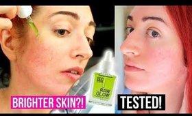 DOES IT WORK? Dewy&Bae Raw Glow TEST! Skin Brightening Serum Review | Jess Bunty
