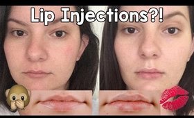 My Lip Injection Experience! Restylane Silk Before & After | OliviaMakeupChannel