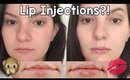 My Lip Injection Experience! Restylane Silk Before & After | OliviaMakeupChannel