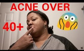Acne Over 40 !  🤓