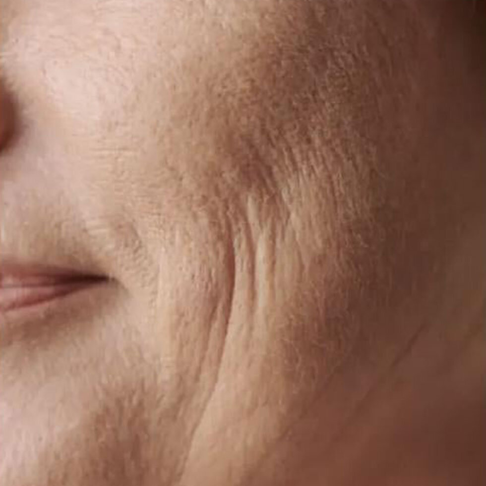 Glamcor's Riki Sculptress Mini targets wrinkles and fine lines