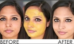 How to Remove Sun Tan From Your Face, Hands & legs Instantly | Home Remedies