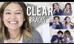 Affordable Clear Braces | Smile Care Club