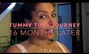16 Months Later Tummy Tuck Journey