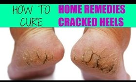 How To Treat CRACKED HEELS At Home | SuperPrincessjo