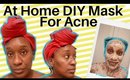 DIY Face Mask For Acne, Blemishes, & Discoloration + Updated Skin Routine