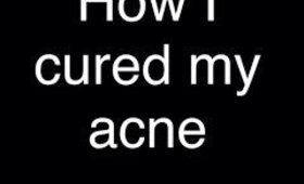 How I cured my acne
