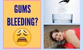 Gums Bleeding After Flossing? Try this!