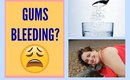 Gums Bleeding After Flossing? Try this!
