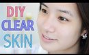 How to: Get Clear Skin & Get Rid of Acne Scars in 3 minutes!