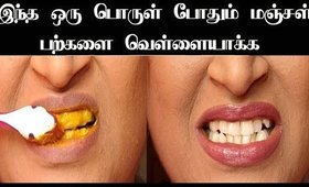 வீட்டிலேயே பற்களை வெள்ளையாக்கலாம் | 100% Teeth Whitening in Tamil