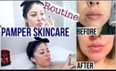 Skincare No More Acne Pamper Routine