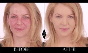 How to cover up birthmarks: Charlotte Tilbury Magic Foundation Makeup Tutorials