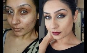 Acne scaring rosacea Foundation routine Indian Olive skin tone|| Raji Osahn