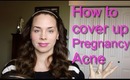 How to Cover Pregnancy Acne - My Full Coverage Foundation Routine!