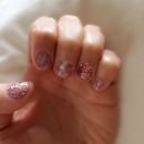 Very short nails