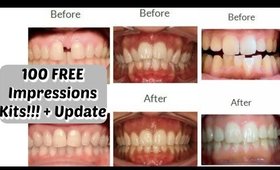 FREE Starter Kit for YOUR At Home Invisible Aligners + Update