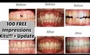 FREE Starter Kit for YOUR At Home Invisible Aligners + Update