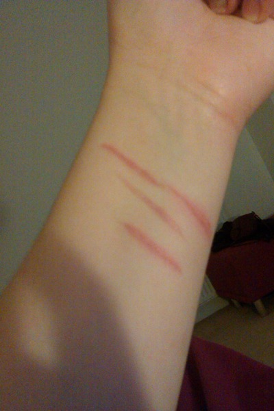 do-these-look-like-self-harm-scars-beautylish