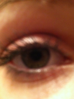 My friends eye