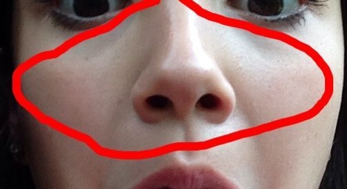 Weird Bumps On My Nose What Are They Beautylish