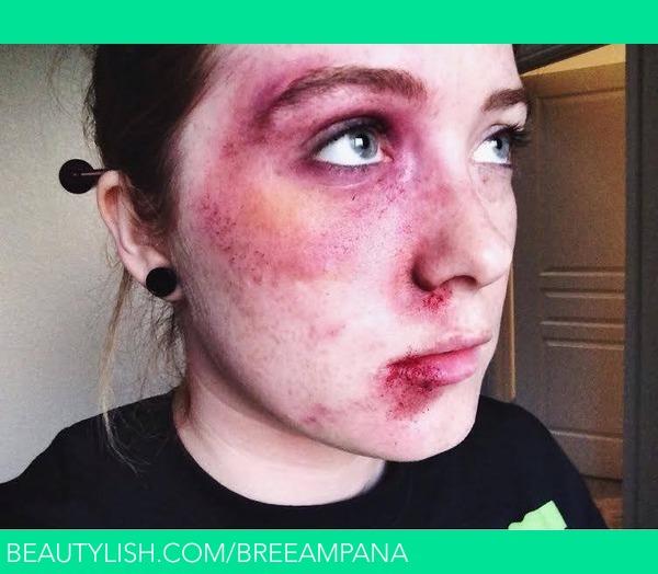 plyndringer Åh gud Bløde Facial Bruising and Bleeding SFX Makeup (Part 3) | Bree H.'s (breeampana)  Photo | Beautylish