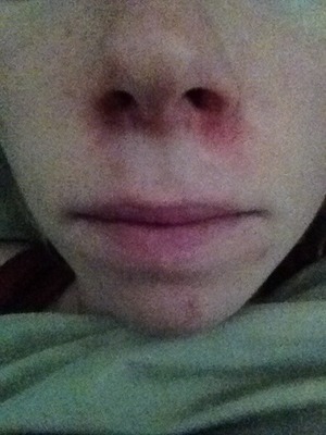 one side of nose. Beautylish