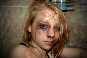 domestic violence photo shoot i did with my boyfriend :)