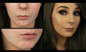 Acne Coverage Foundation Routine | Eimear McElheron