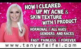 How I Cleared Up My Acne & Skin Texture With 1 Product | Fast & Painless | Tanya Feifel