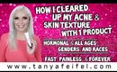 How I Cleared Up My Acne & Skin Texture With 1 Product | Fast & Painless | Tanya Feifel
