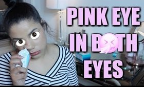 pink eye in BOTH my eyes | Hammied With Haley