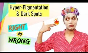 Right Vs Wrong || Hyper-Pigmentation, Dark Spots, Acne Scars || Shruti Arjun Anand