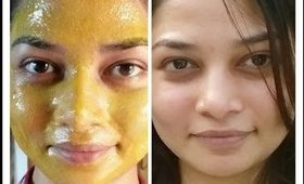 Acne fighting mask
