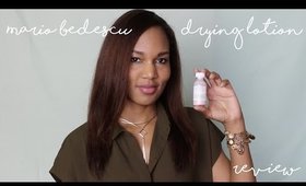 Bye Zits! Mario Bedescu Drying Lotion Review ◌ alishainc