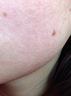 Small flesh colored bumps on my face? | Beautylish