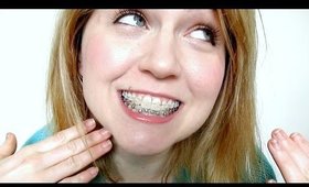 Why I Decided to Get Braces [Again] [QTT]