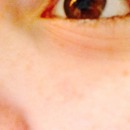 Josh's eye