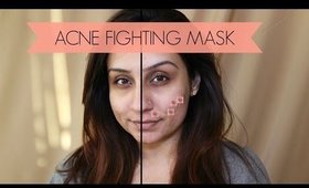 How To - Acne fighting mask cystic acne bacne teenage acne | Makeup With Raji
