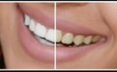 How To Whiten Teeth at Home! FAST & CHEAP