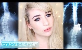 MY SCOLIOSIS STORY | Born with a deformity