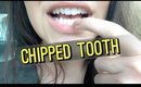 JULIES WORLD: Chipped Tooth